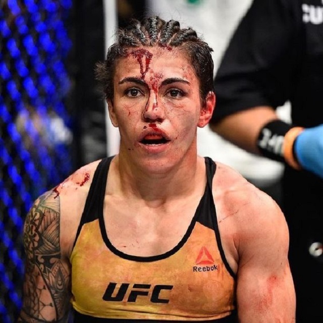 包含博卡青年门将安德拉德获西甲最佳门将的词条